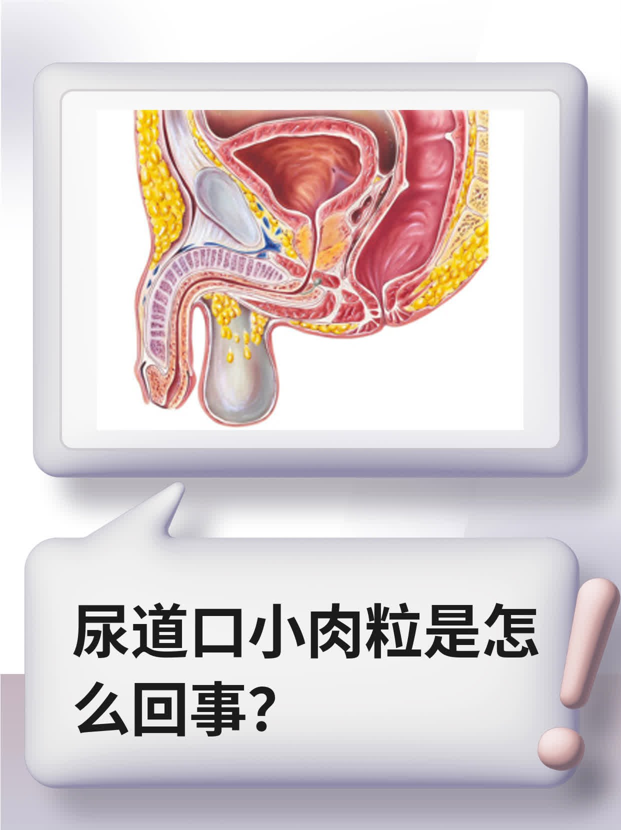 尿道口长小肉颗粒图片