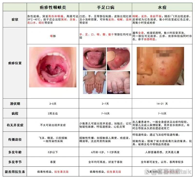 水痘辨认 小儿图片