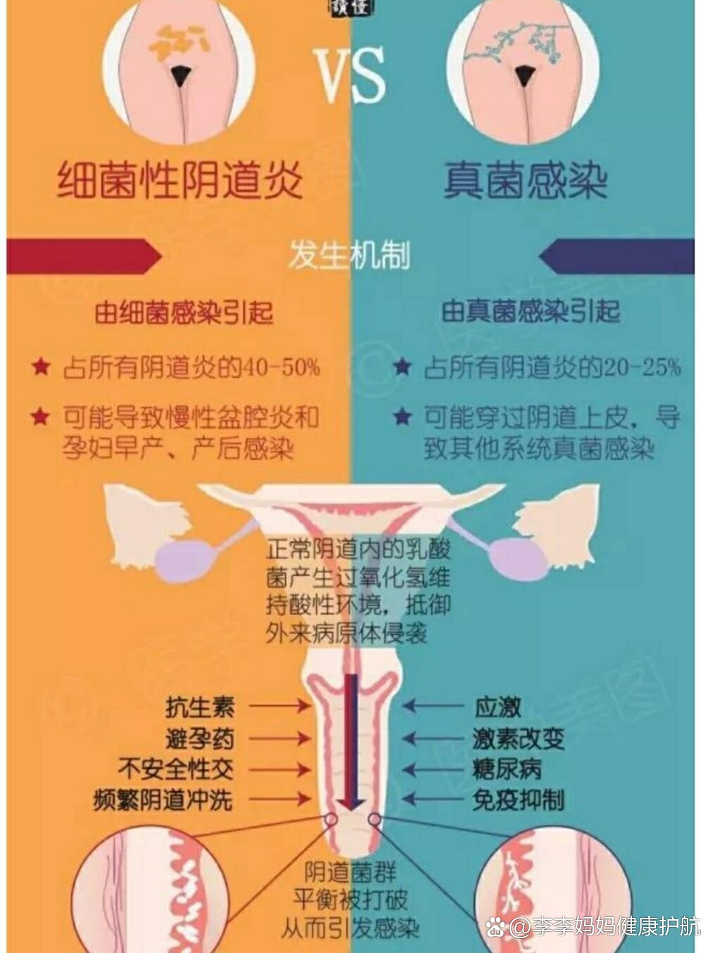 女性下面真菌感染图片