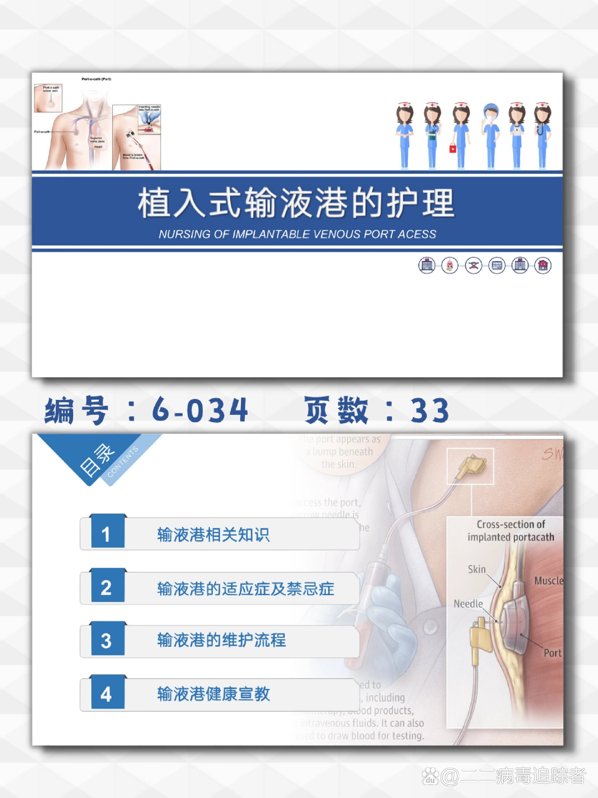 输液港适应症图片