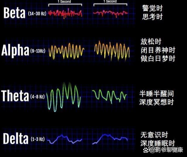 异常脑电图尖波尖慢波图片