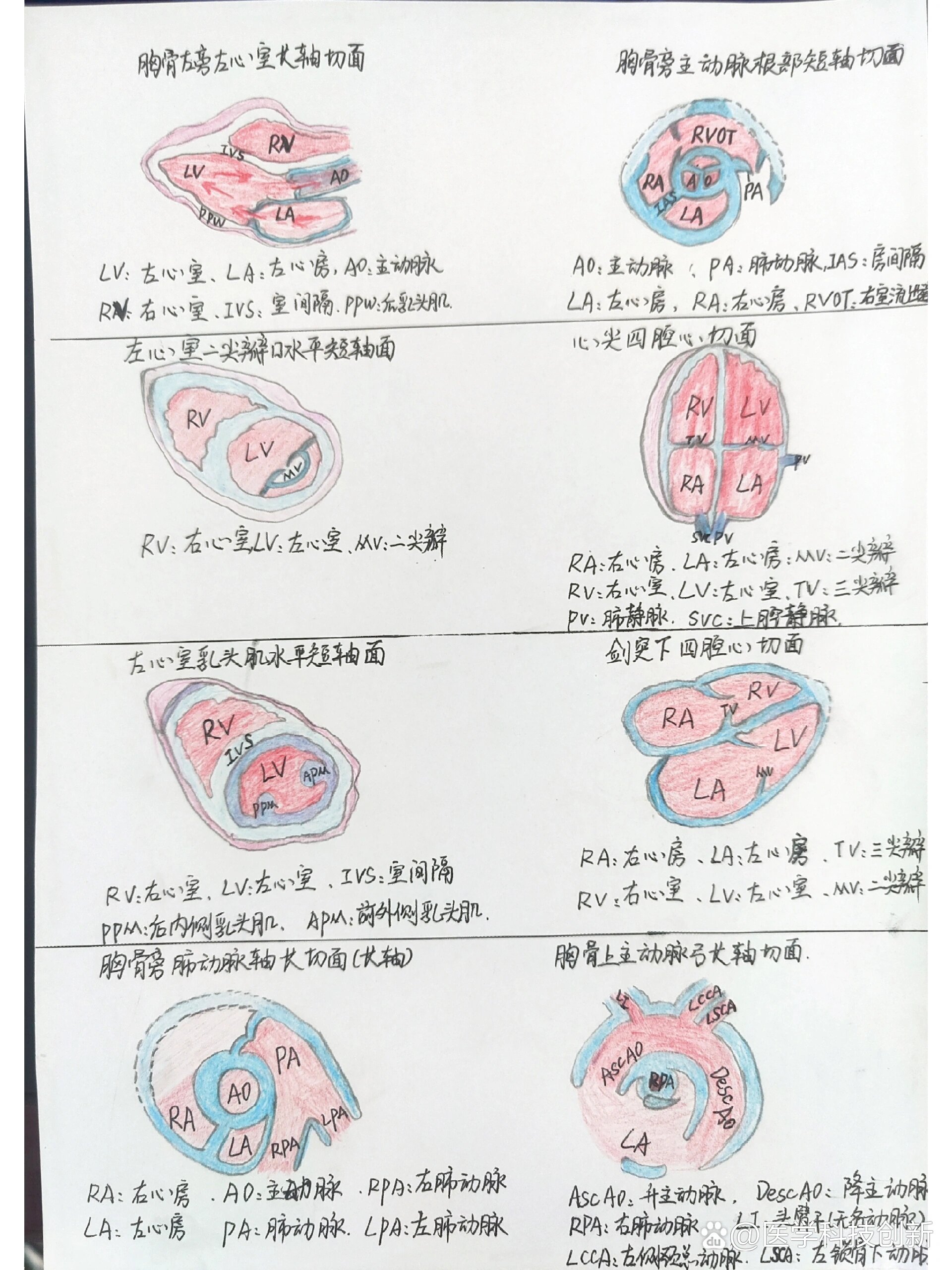 心肌纵切图图片