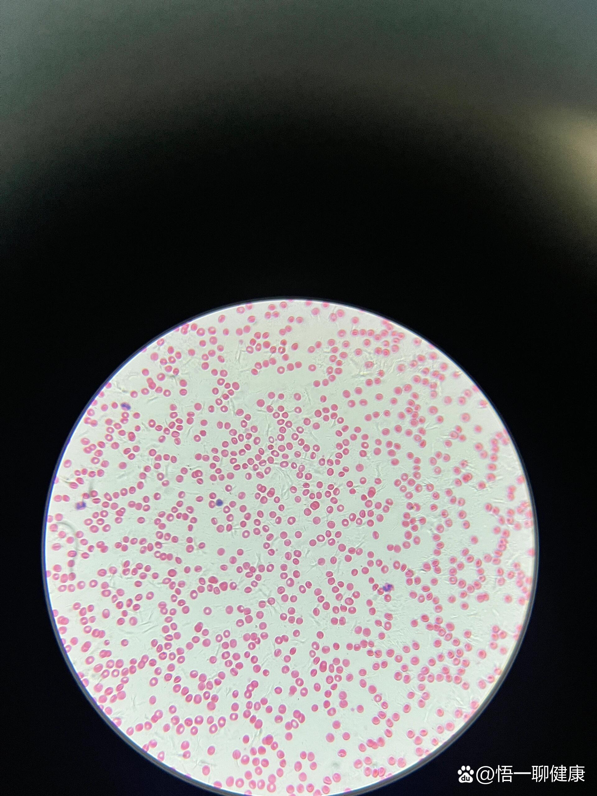 显微镜94下的人血涂片