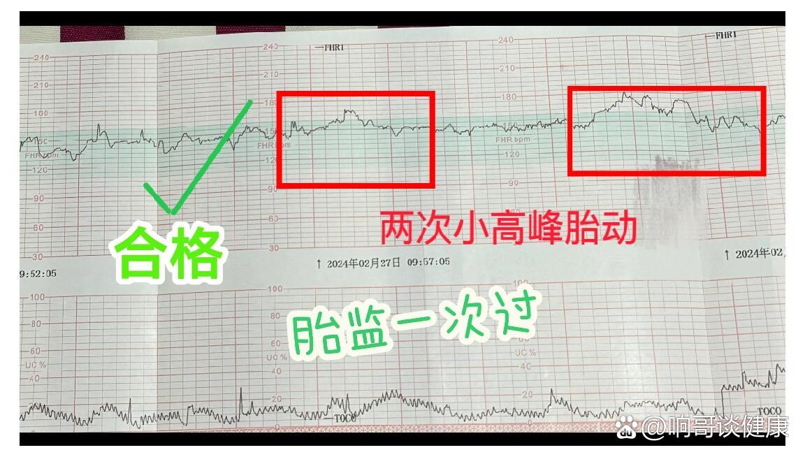 孕35周 胎心监护一次过的经验总结进入孕35周,第一次去做了