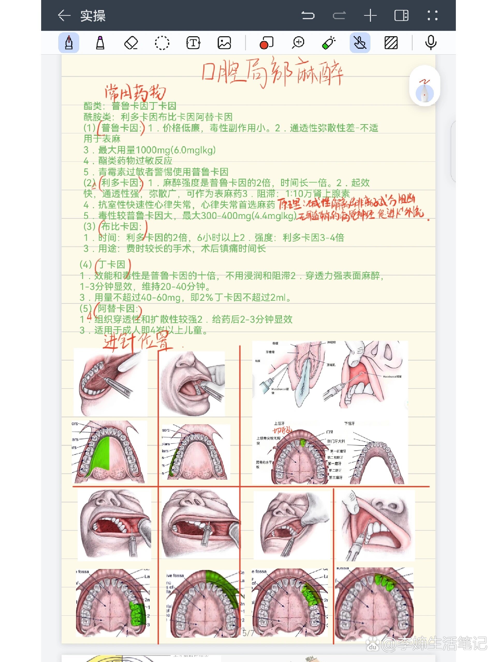 口腔局麻常用药物以及进针位置目标神经