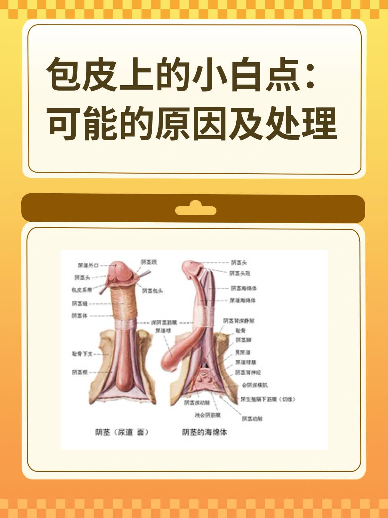 包茎白色污垢怎么处理图片