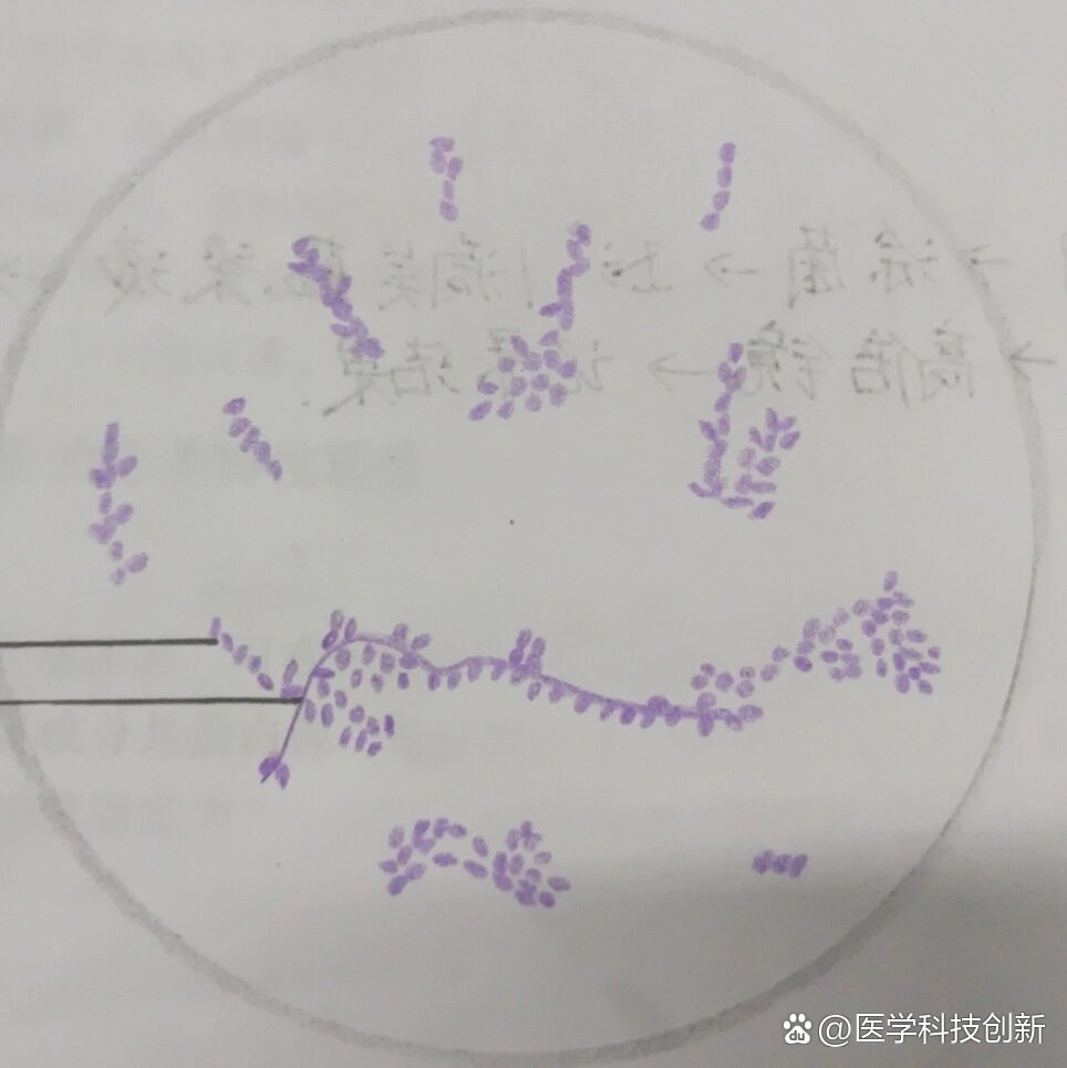 白色念珠菌革兰氏染色手绘