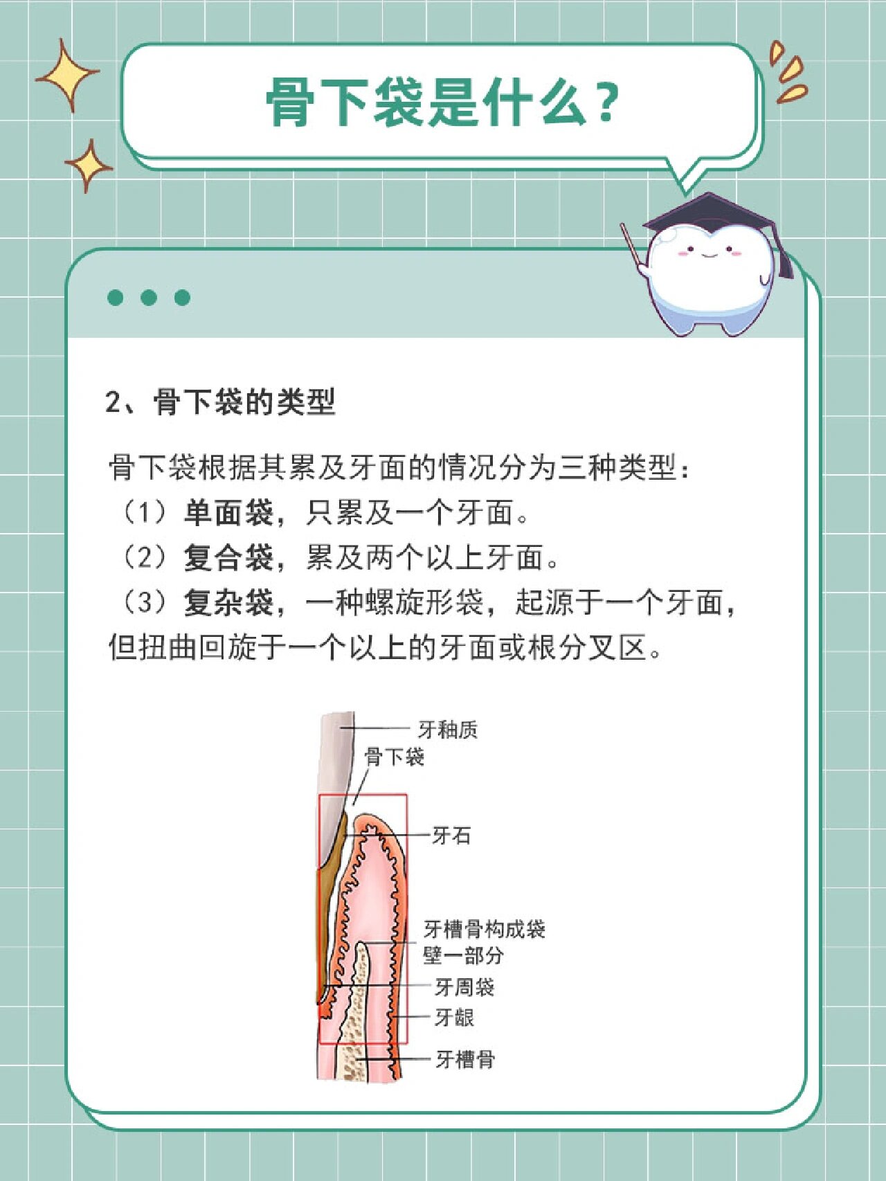 骨下袋是什么❓骨下袋❗❗是一种真性的牙周袋,袋底位于