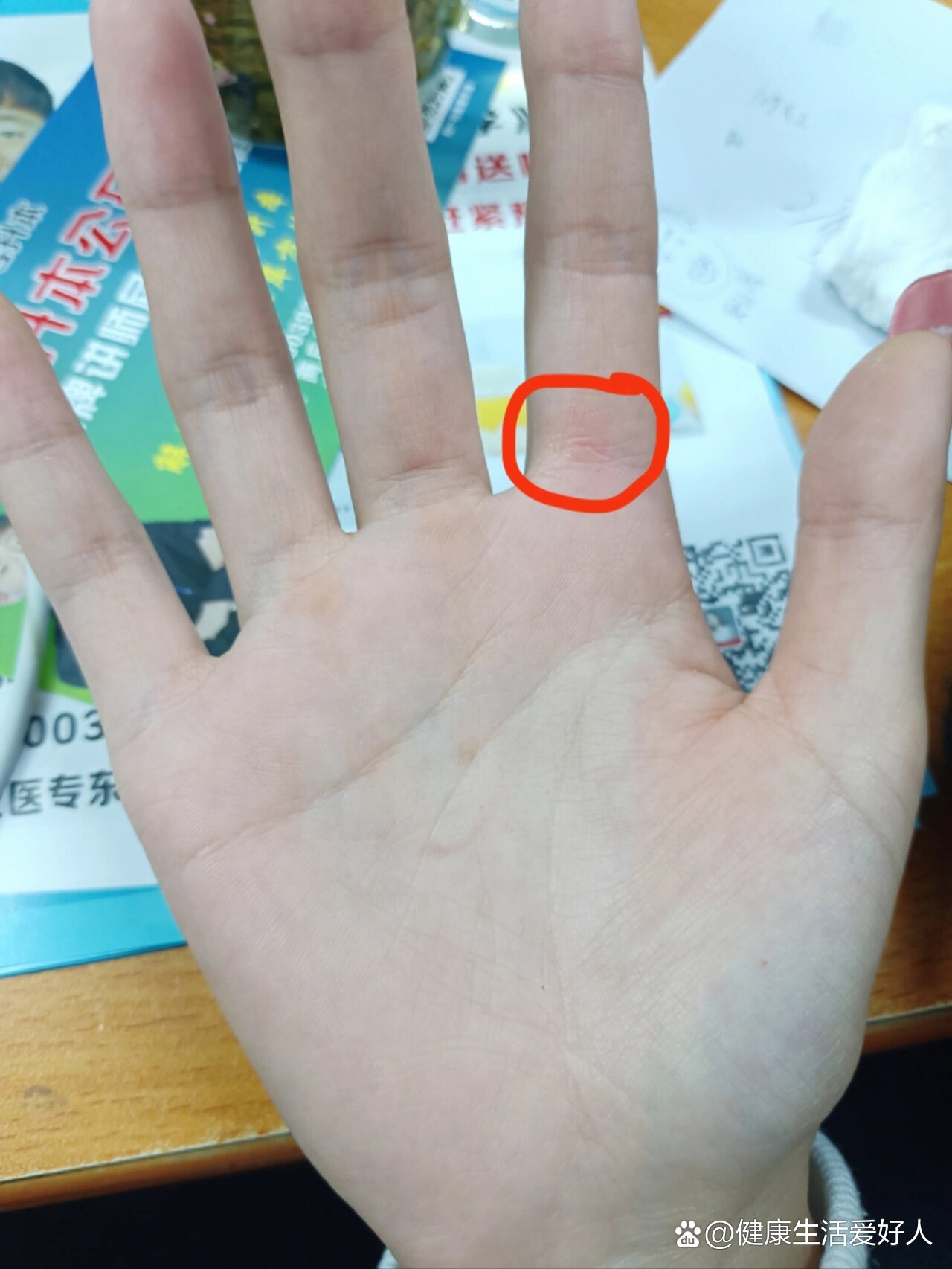 右手食指长个小疙瘩