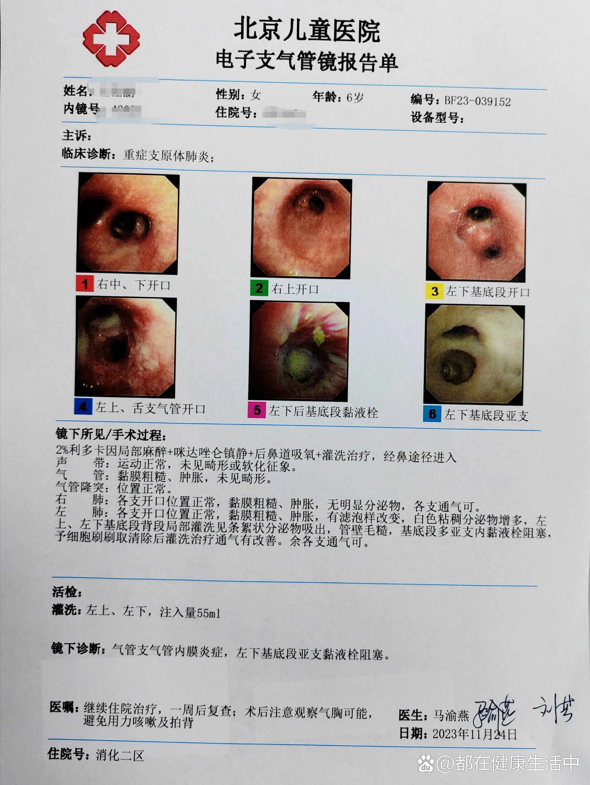 支气管镜下病变图谱图片