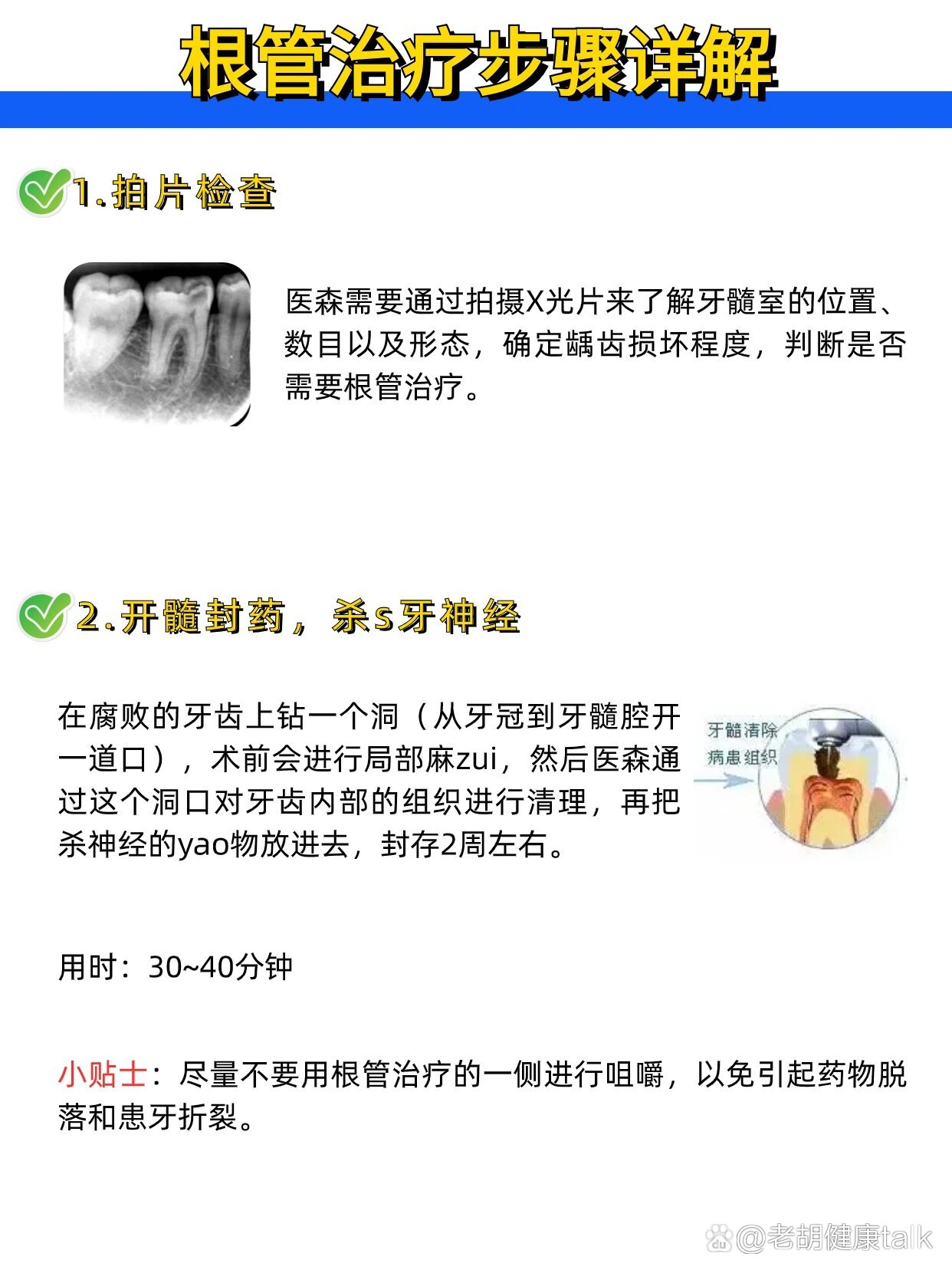 根管治疗详细步骤,看完就知道怎么做!