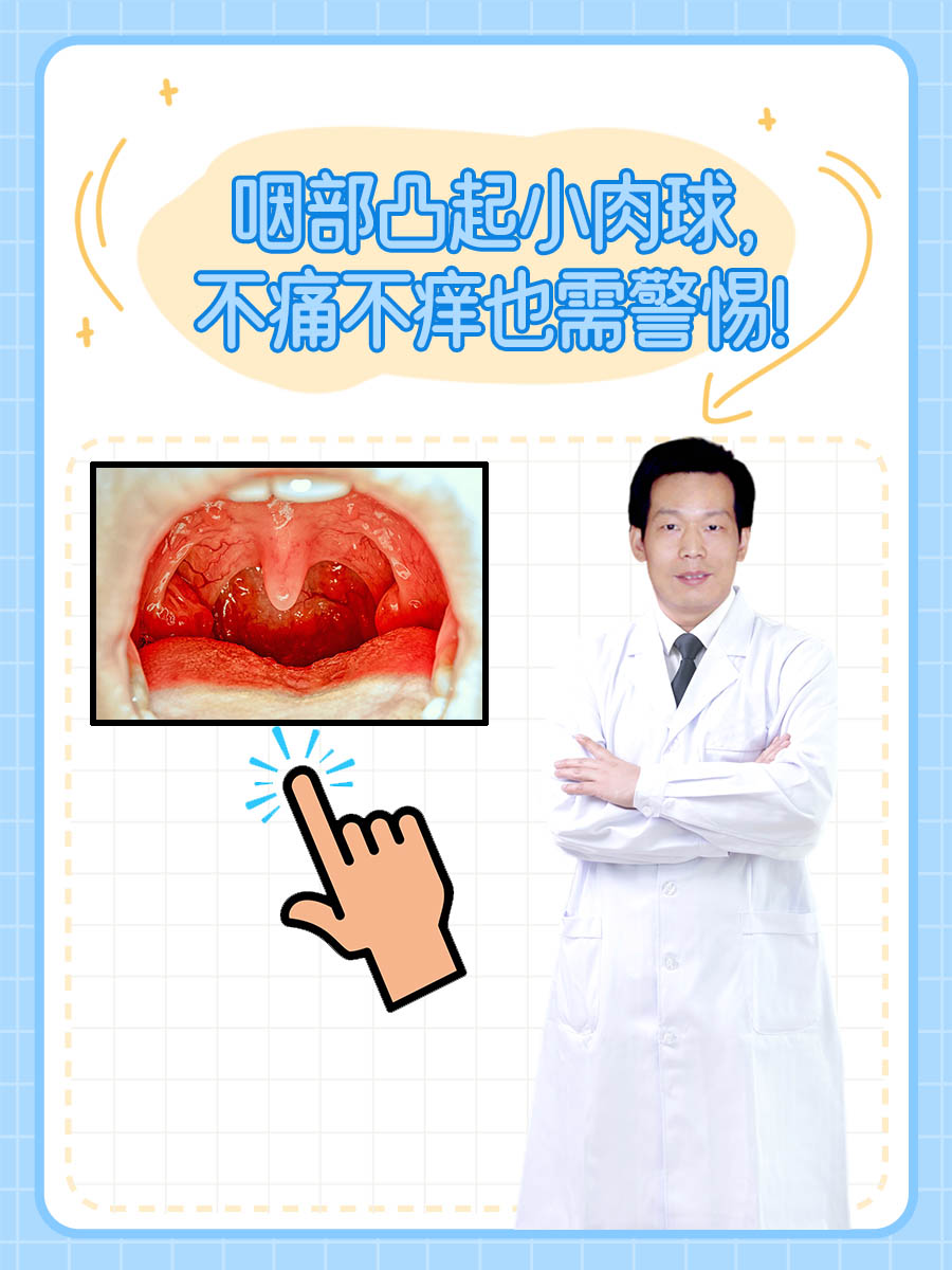 咽部凸起小肉球,不痛不痒也需警惕!
