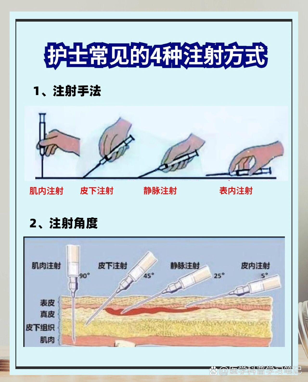 关节腔注射步骤示意图图片