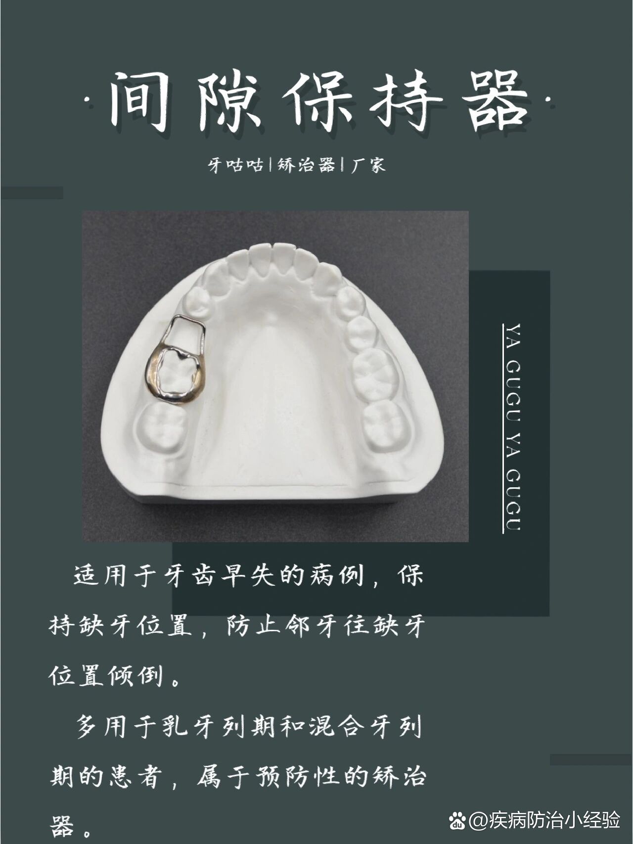 乳牙早失小帮手间隙保持器来啦