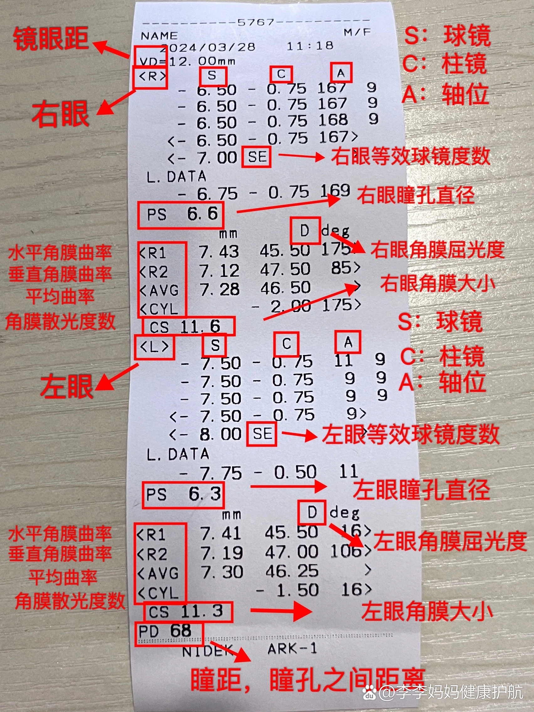  p>如何通过验光单看懂你的眼睛度数 br>是不是很多宝子们,拿到视力