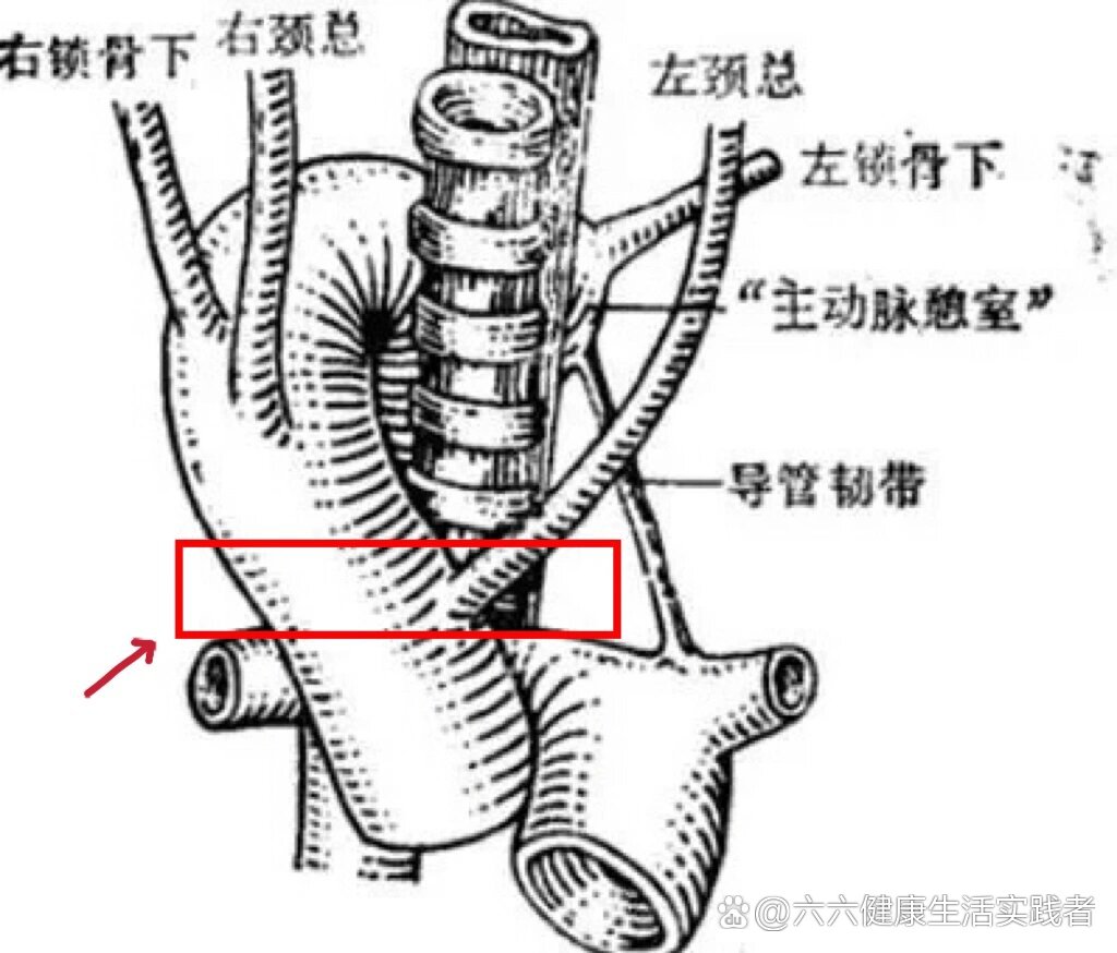 主动脉弓突出图片