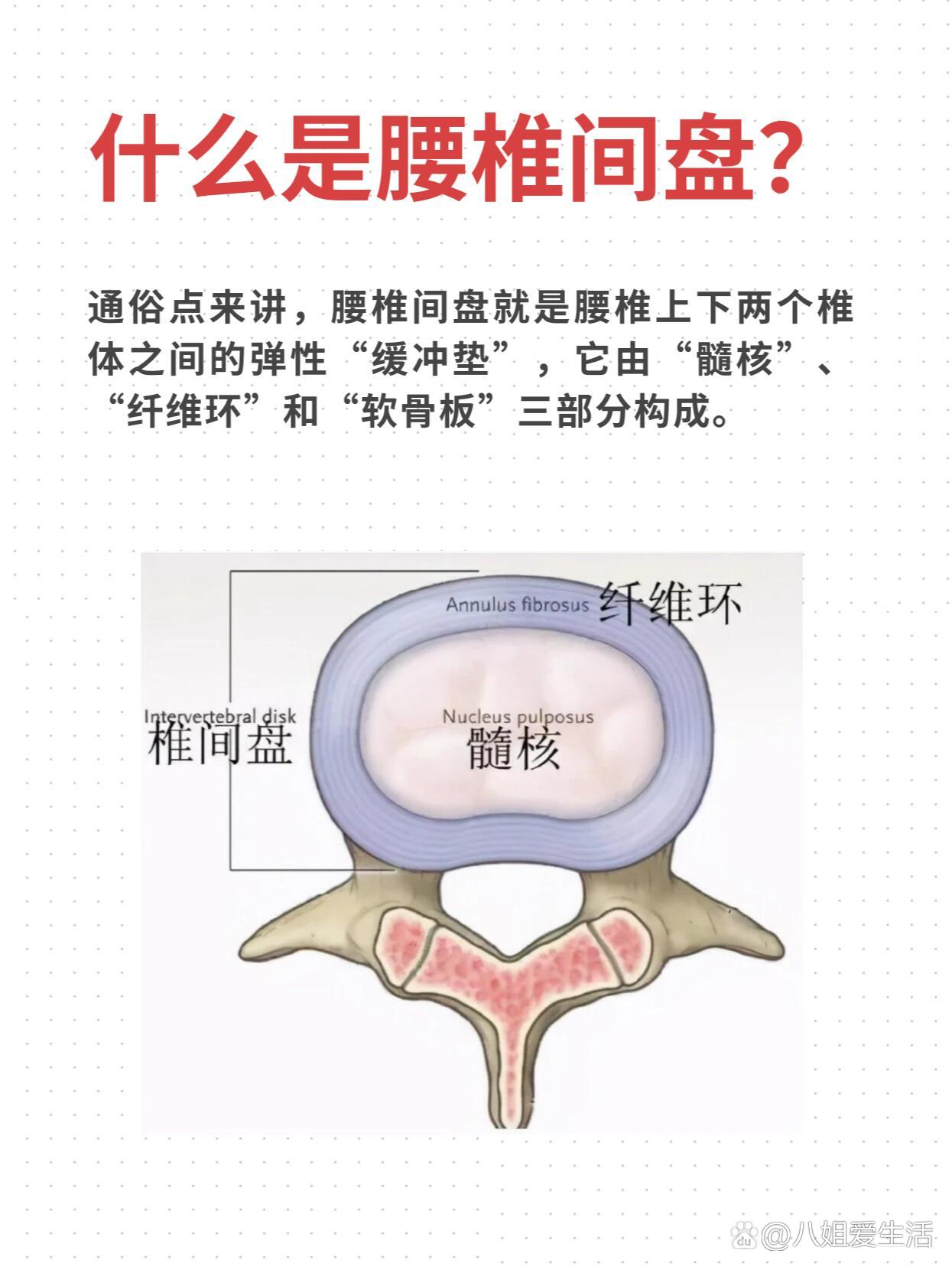 一文带您了解腰椎间盘突出!