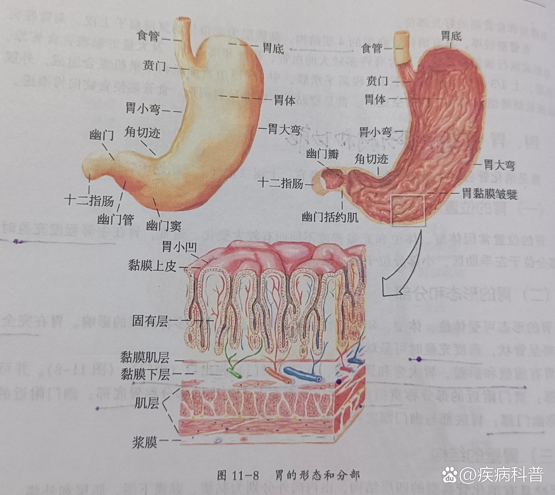 胃溃疡底部四层结构图图片