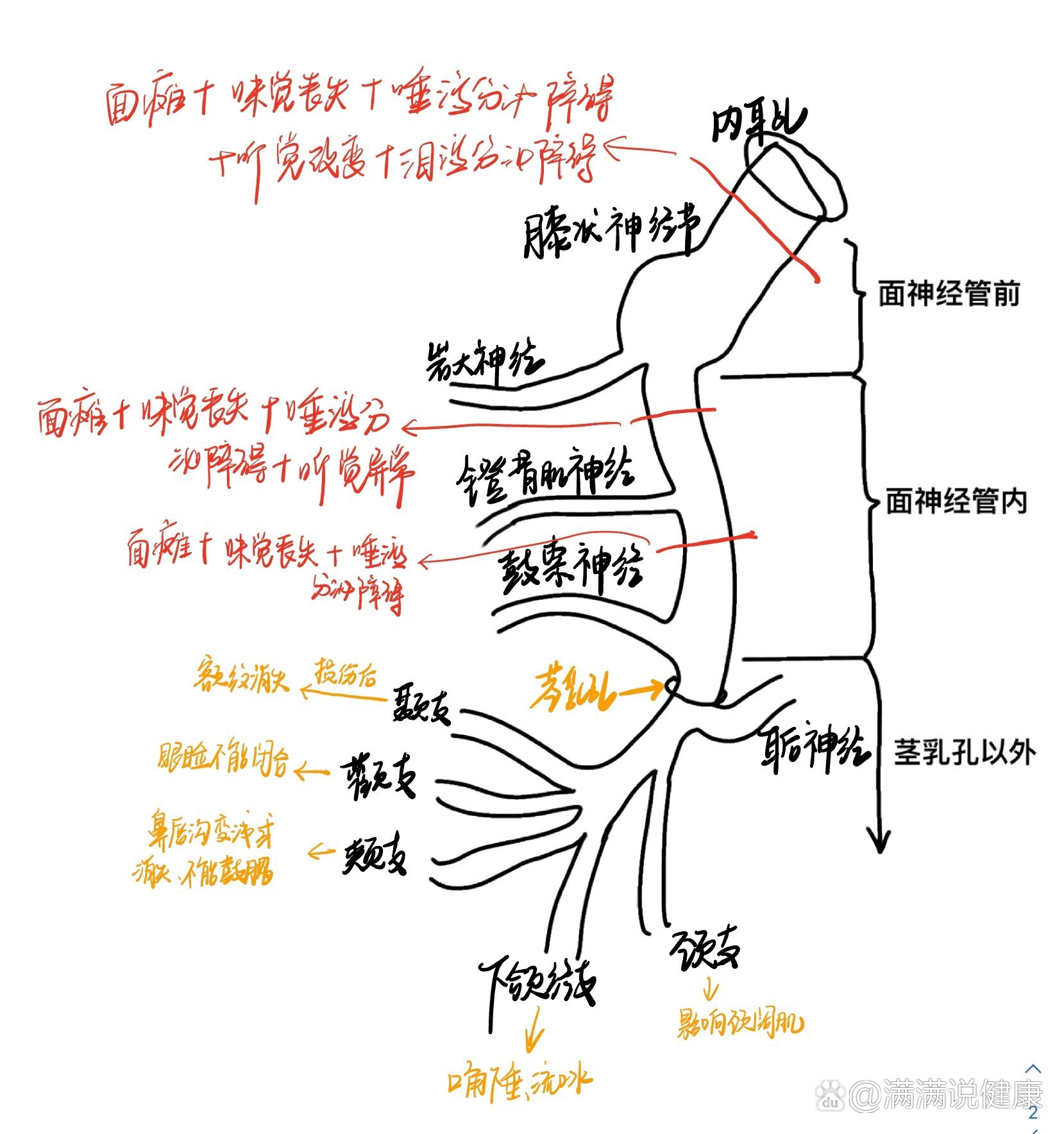 图示面神经分支分布及损伤后表现