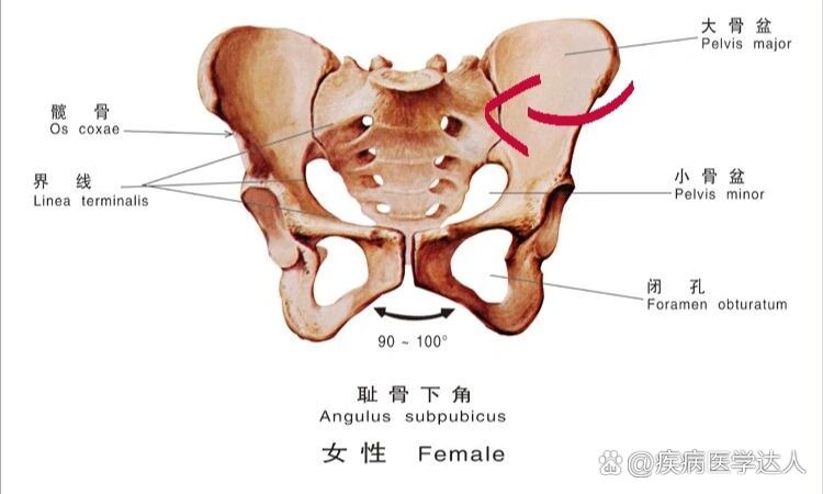 你一定不知道还有单侧骨盆旋前