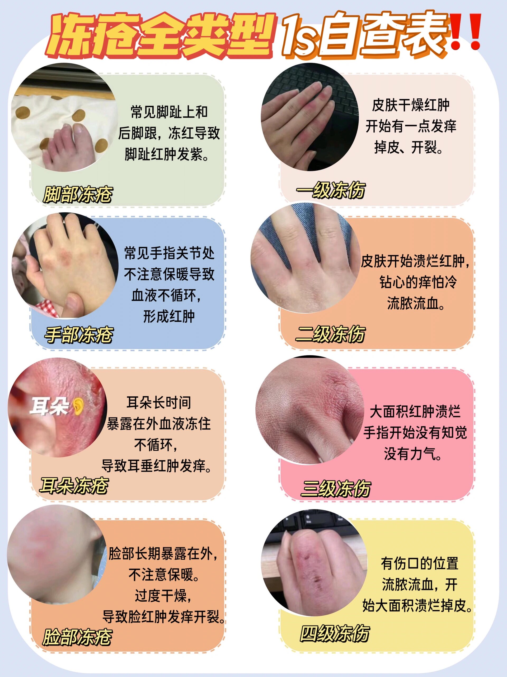 为什么会冻伤皮肤百科在线