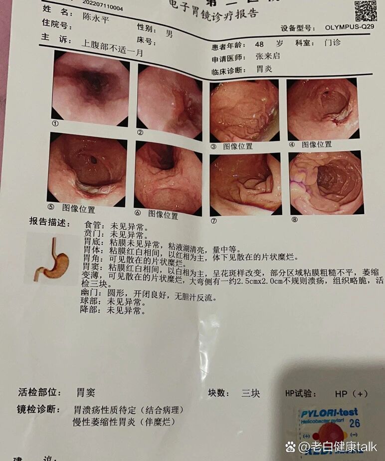 胃癌化验单图片