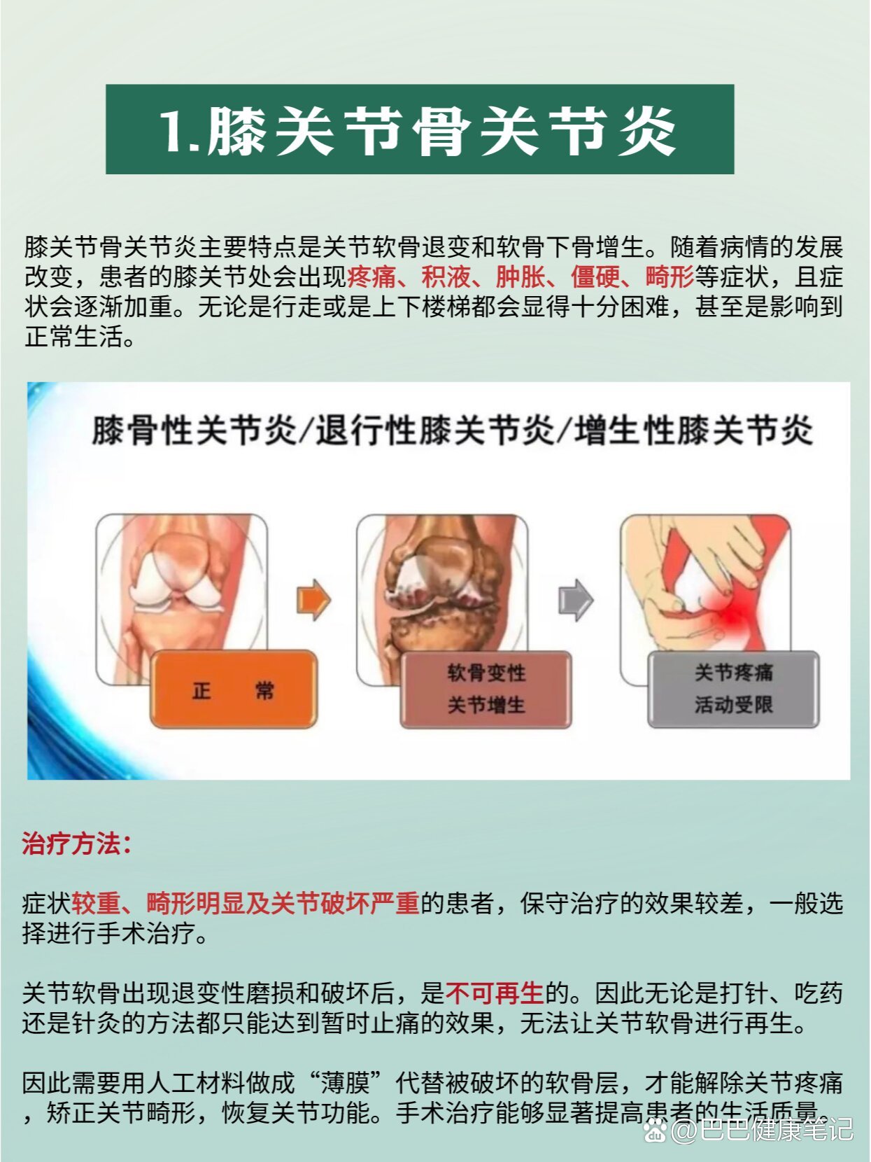 8种膝盖疼痛常见病和治疗方法!