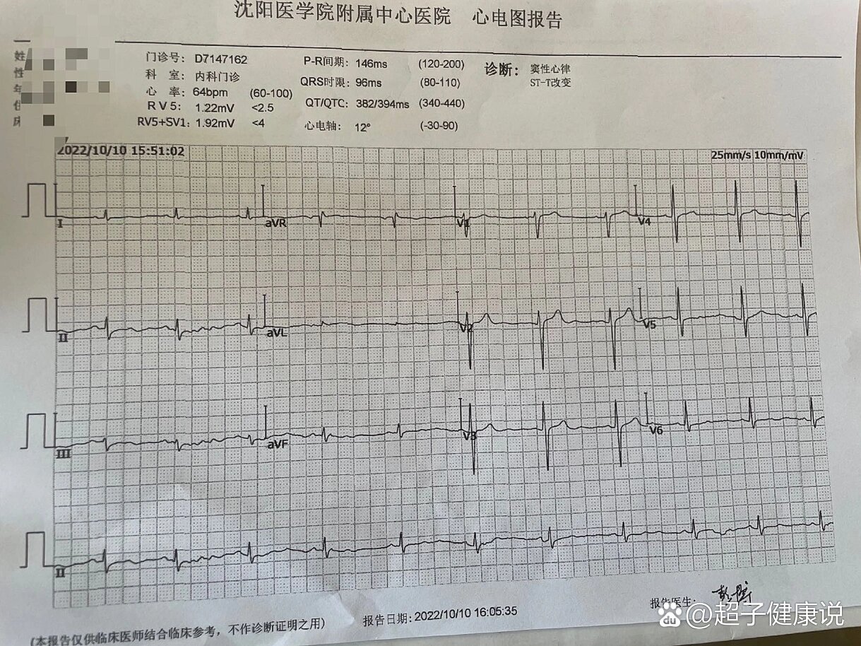 入职体检心电图st