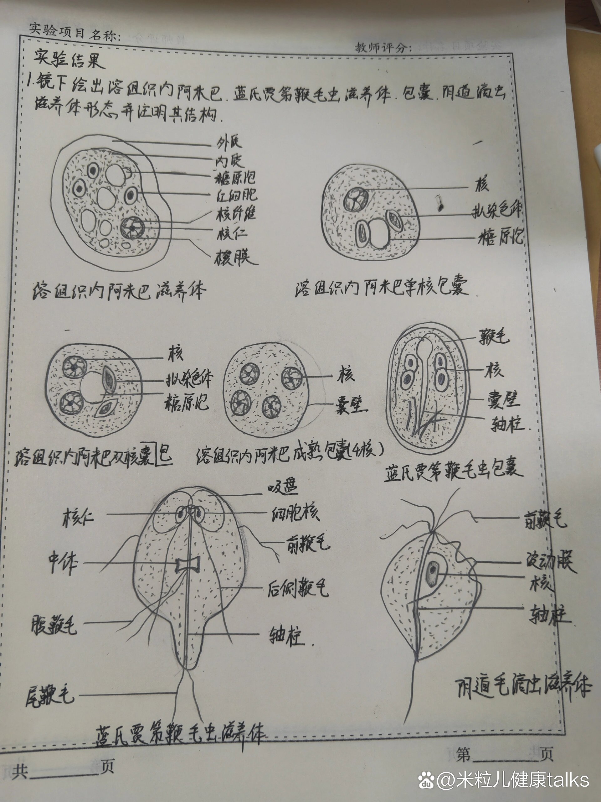 微生物与寄生虫实验报告溶组织内阿米巴滋养体