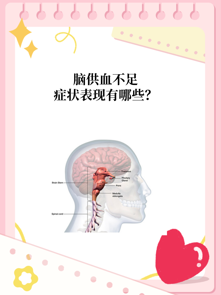 脑供血不足症状表现有哪些