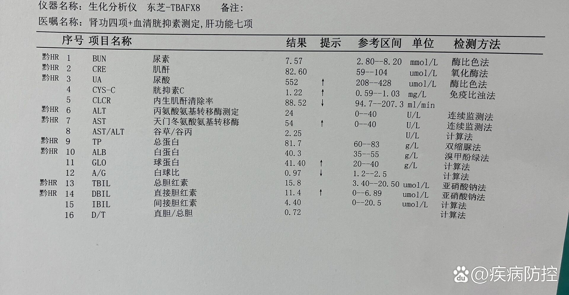 痛风,请问这个检查单指标是啥意思?