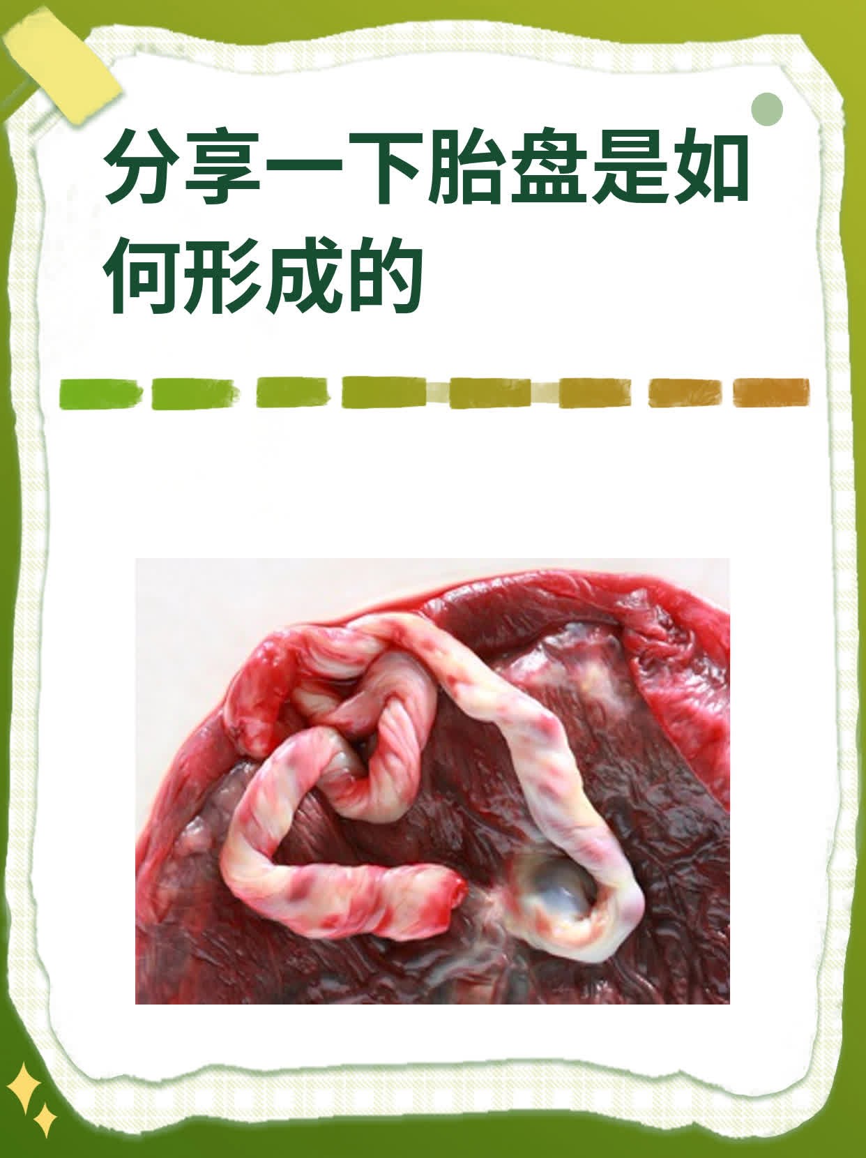 分享一下胎盘是如何形成的