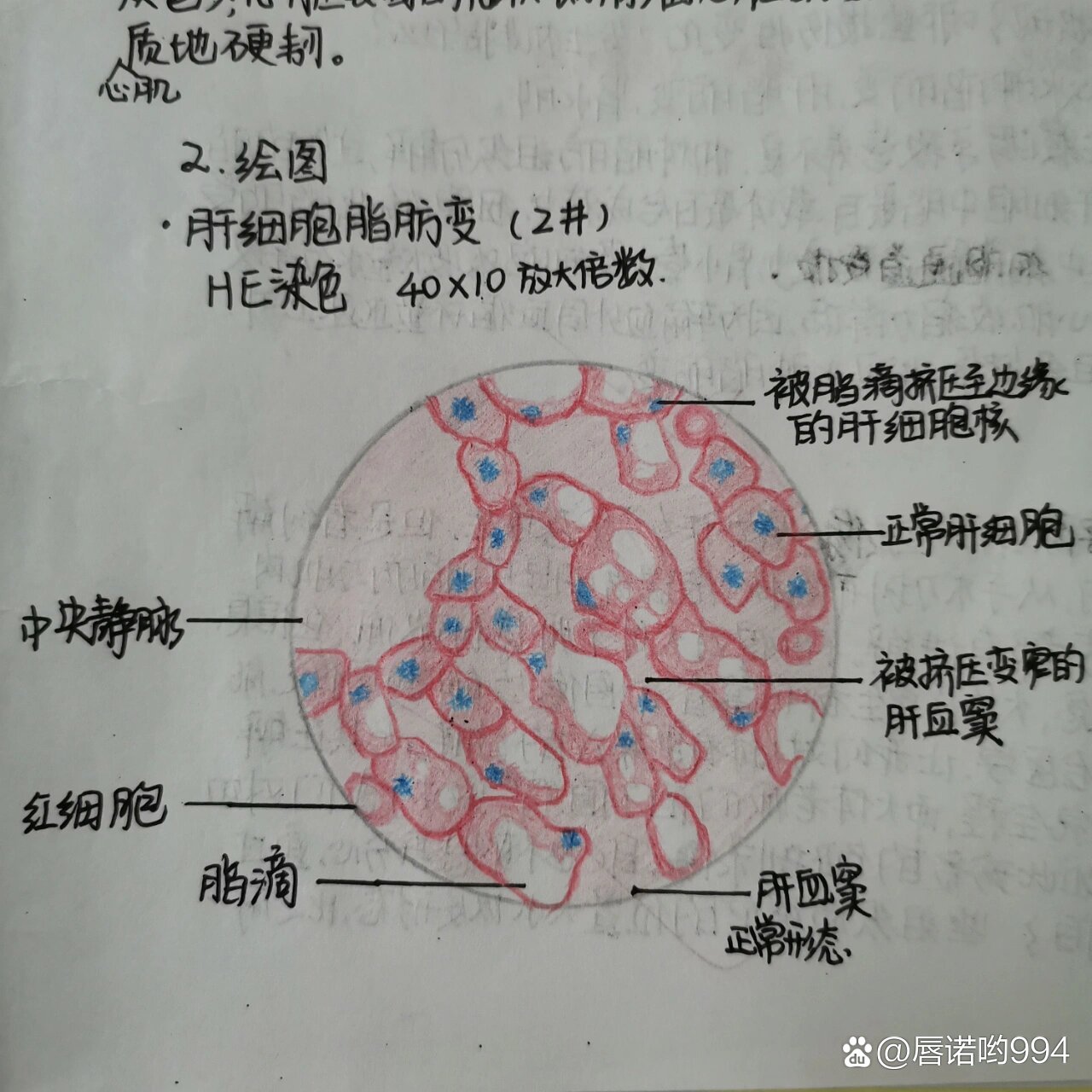 这次是细胞损伤&局部血液循环障碍&炎症的标本切片红蓝铅笔绘图🔬