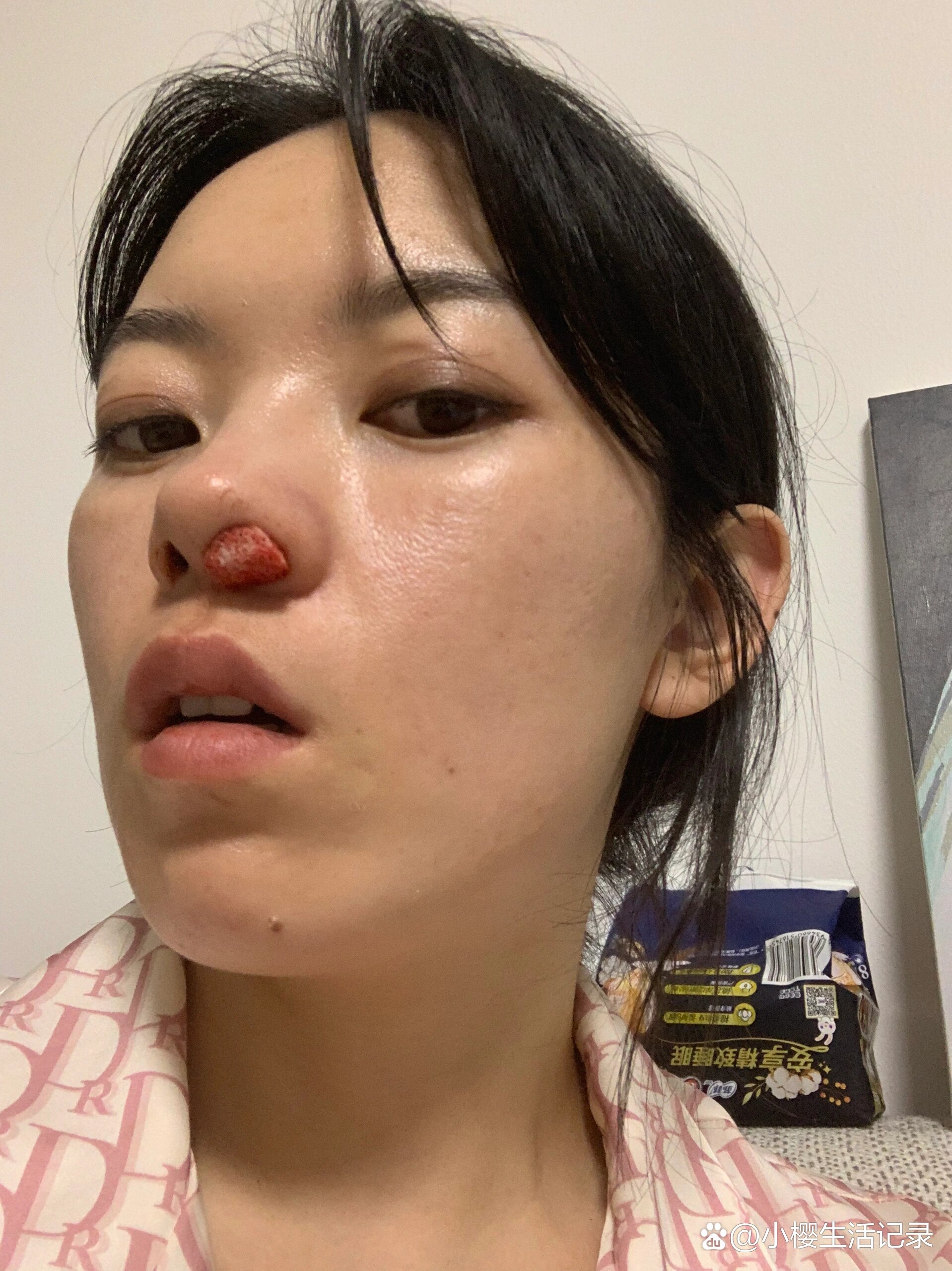 流鼻血狂流不止