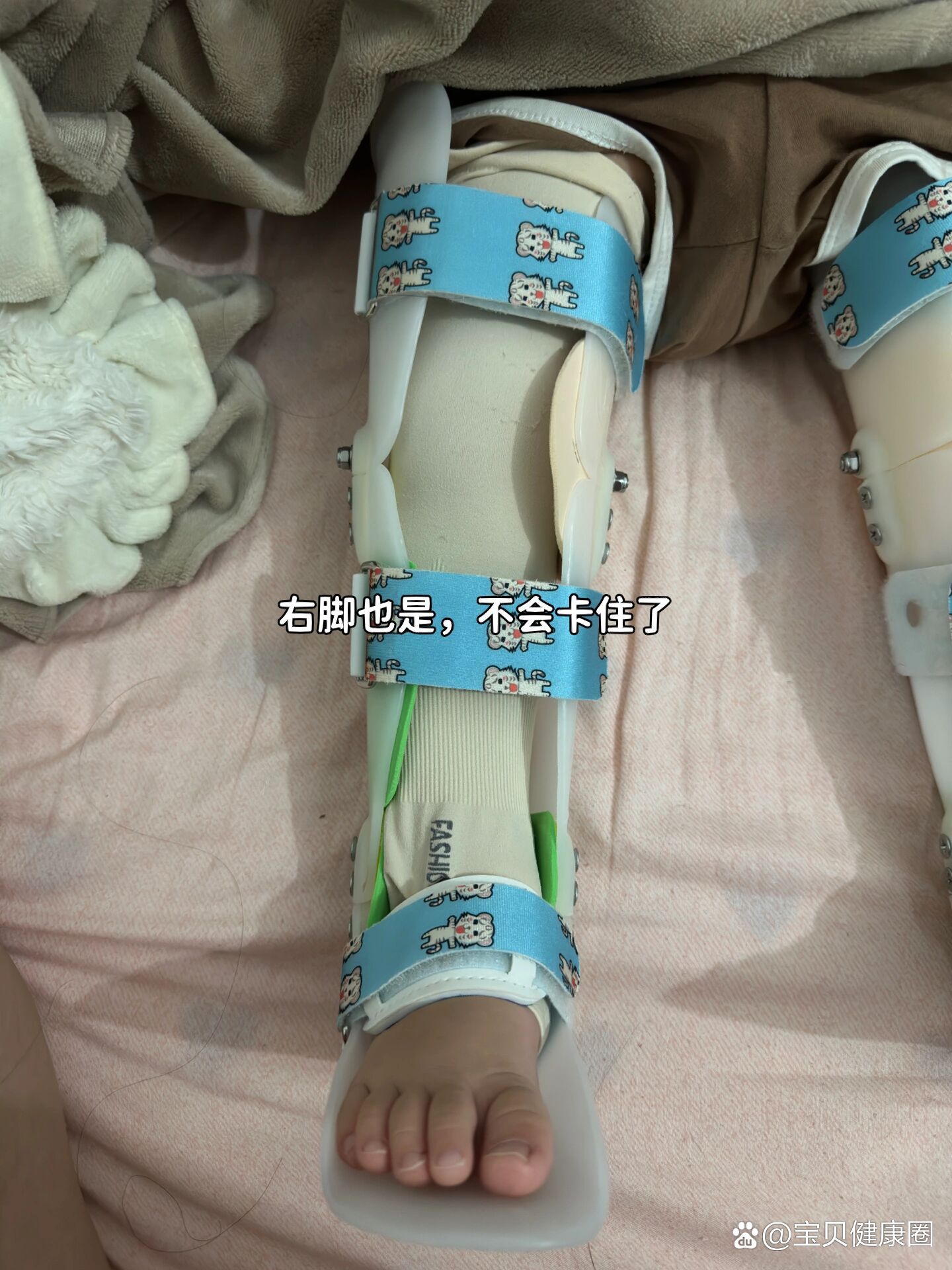 看o型腿挂什么科?
