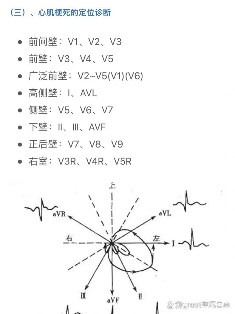 胸导联v1到v6的位置图片