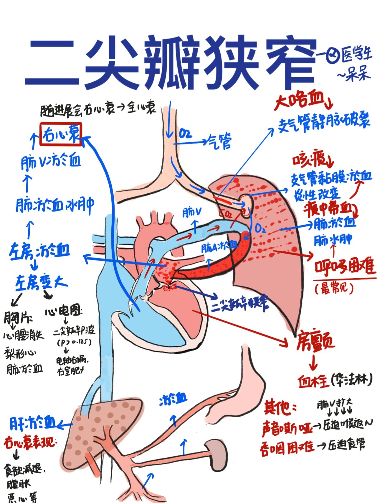 二尖瓣前叶冗长图片