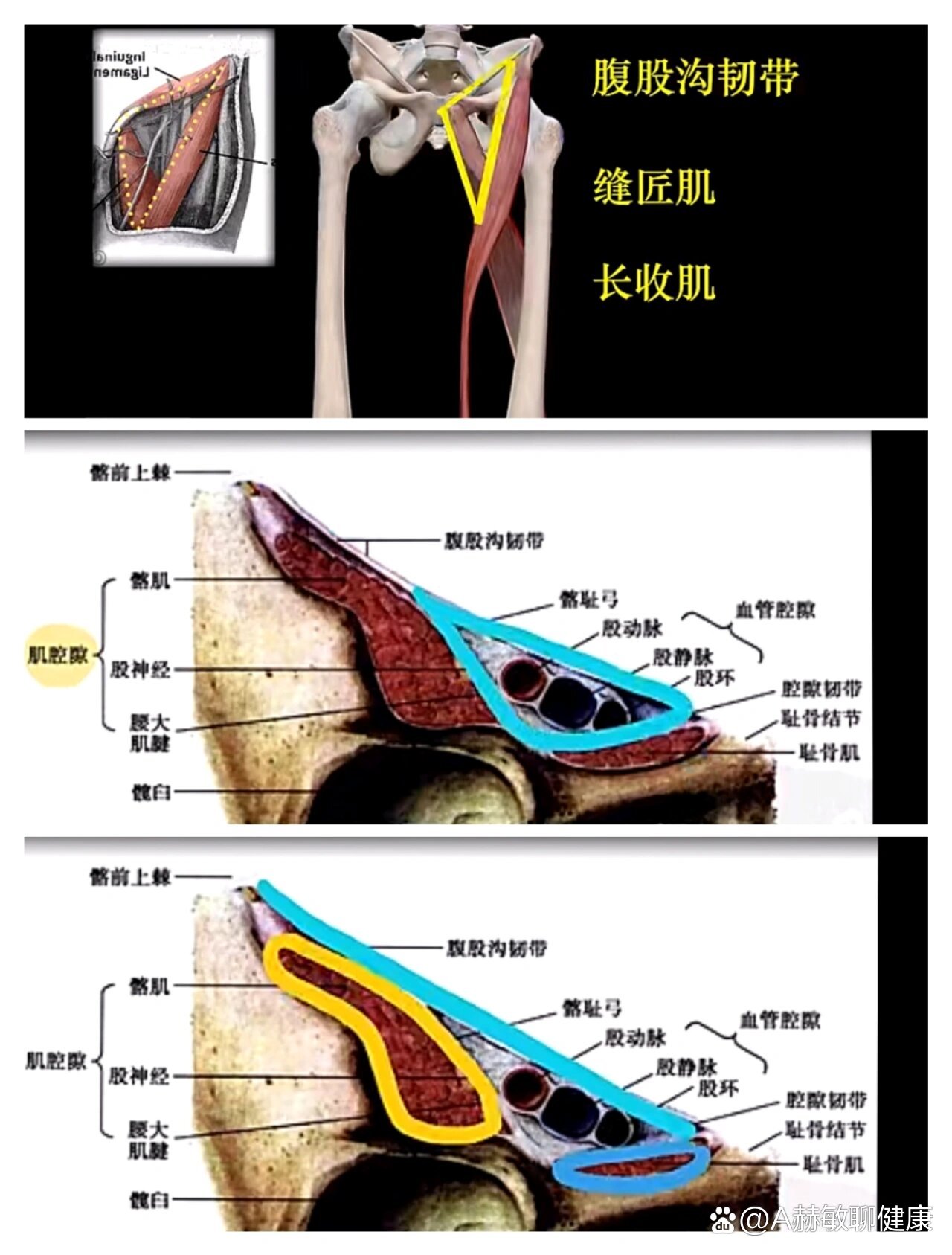 大腿缝隙三角图片