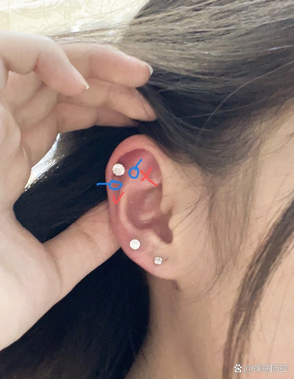 耳骨位置禁忌!