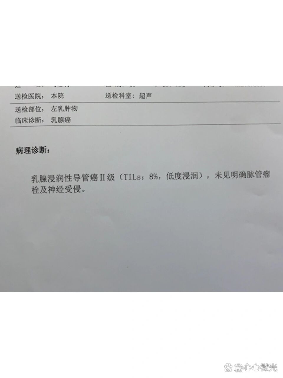 乳腺浸润性导管癌保乳放疗or全切?