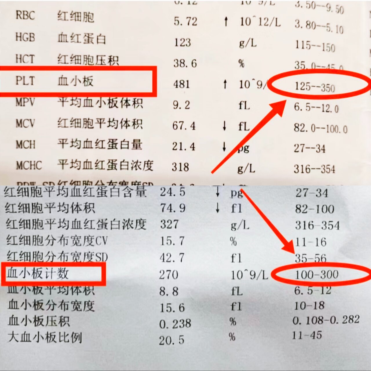 血小板正常值是多少?图片