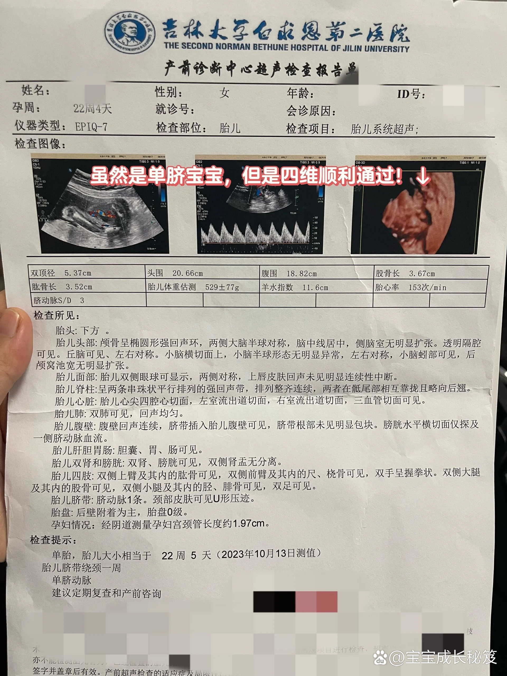 产检|选择上午做四维,一次就顺利通过了73