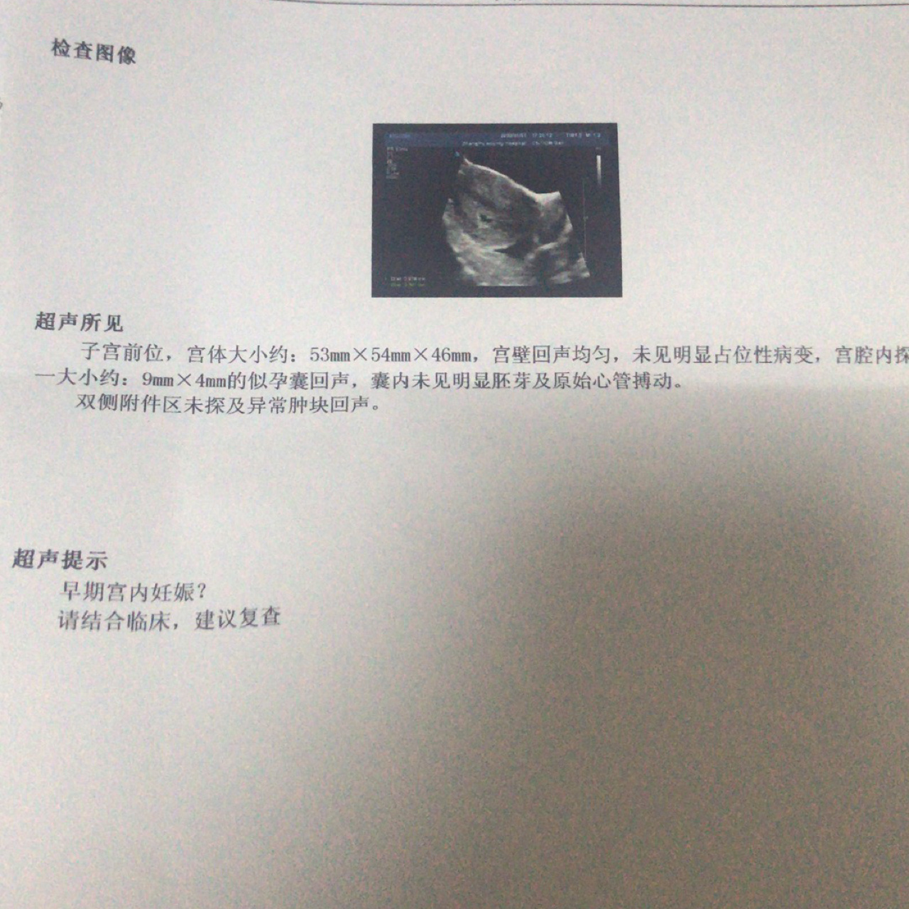 谈谈双角子宫备孕的那些事儿