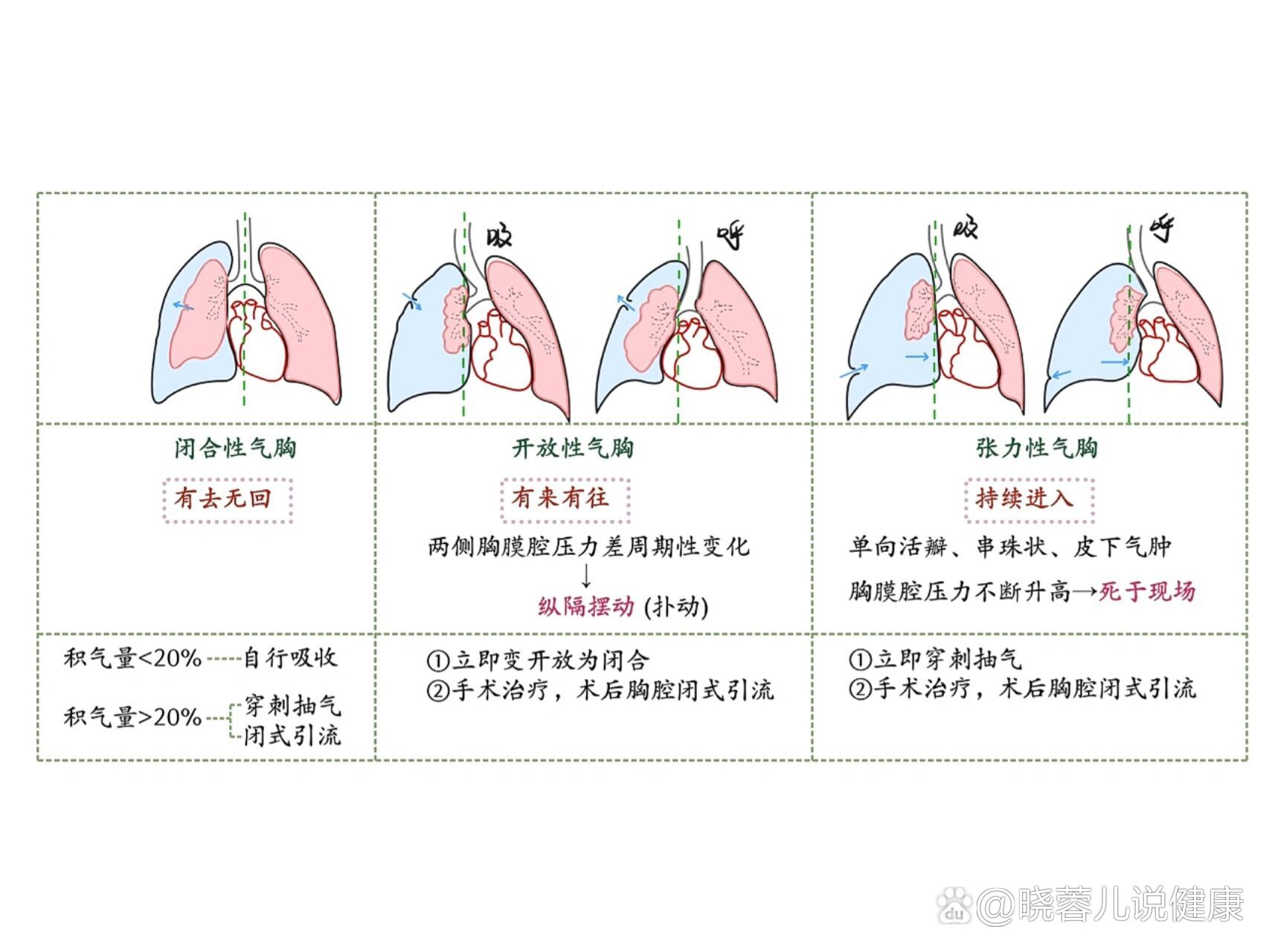 张力性气胸患者图片