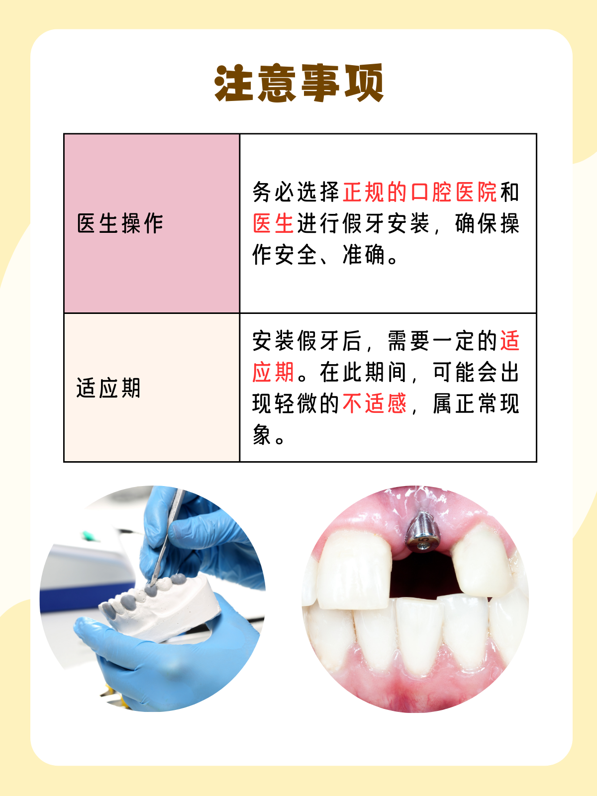 假牙价格大揭秘,让你心中有数!