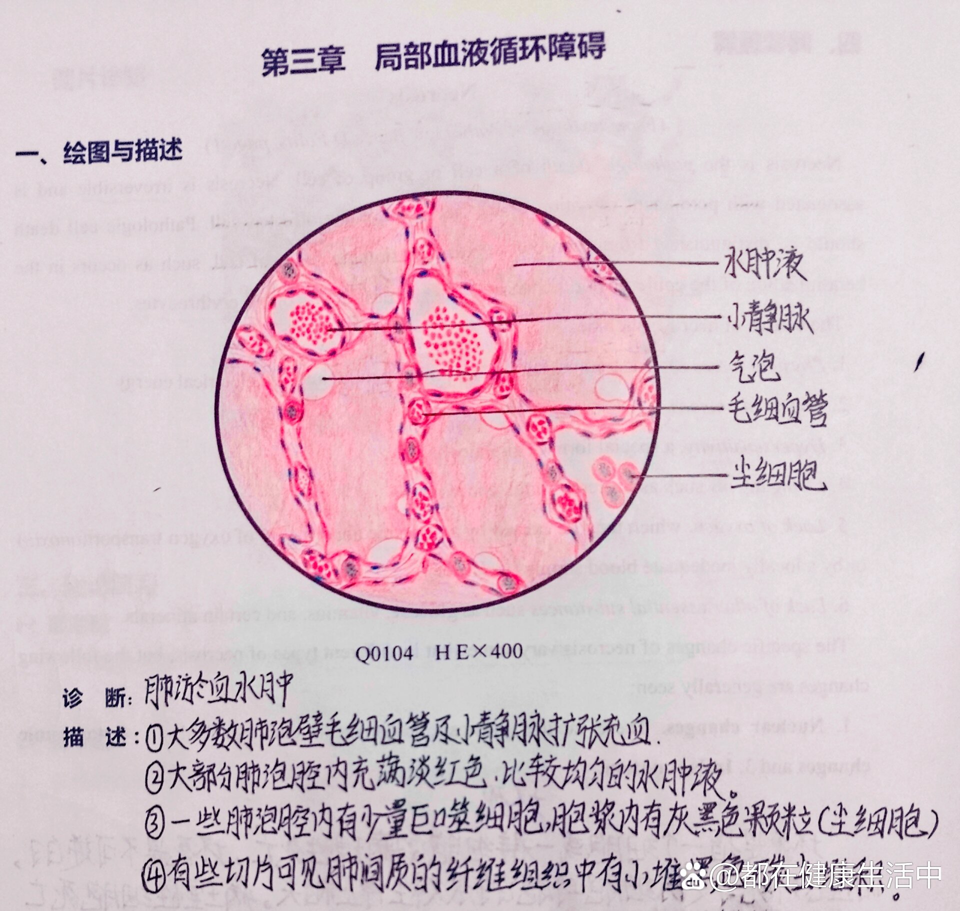 煤污病显微图图片