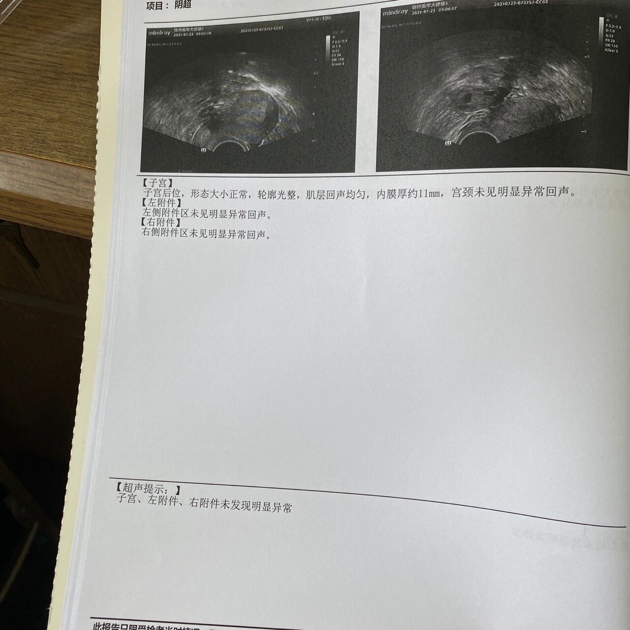 阴超体检