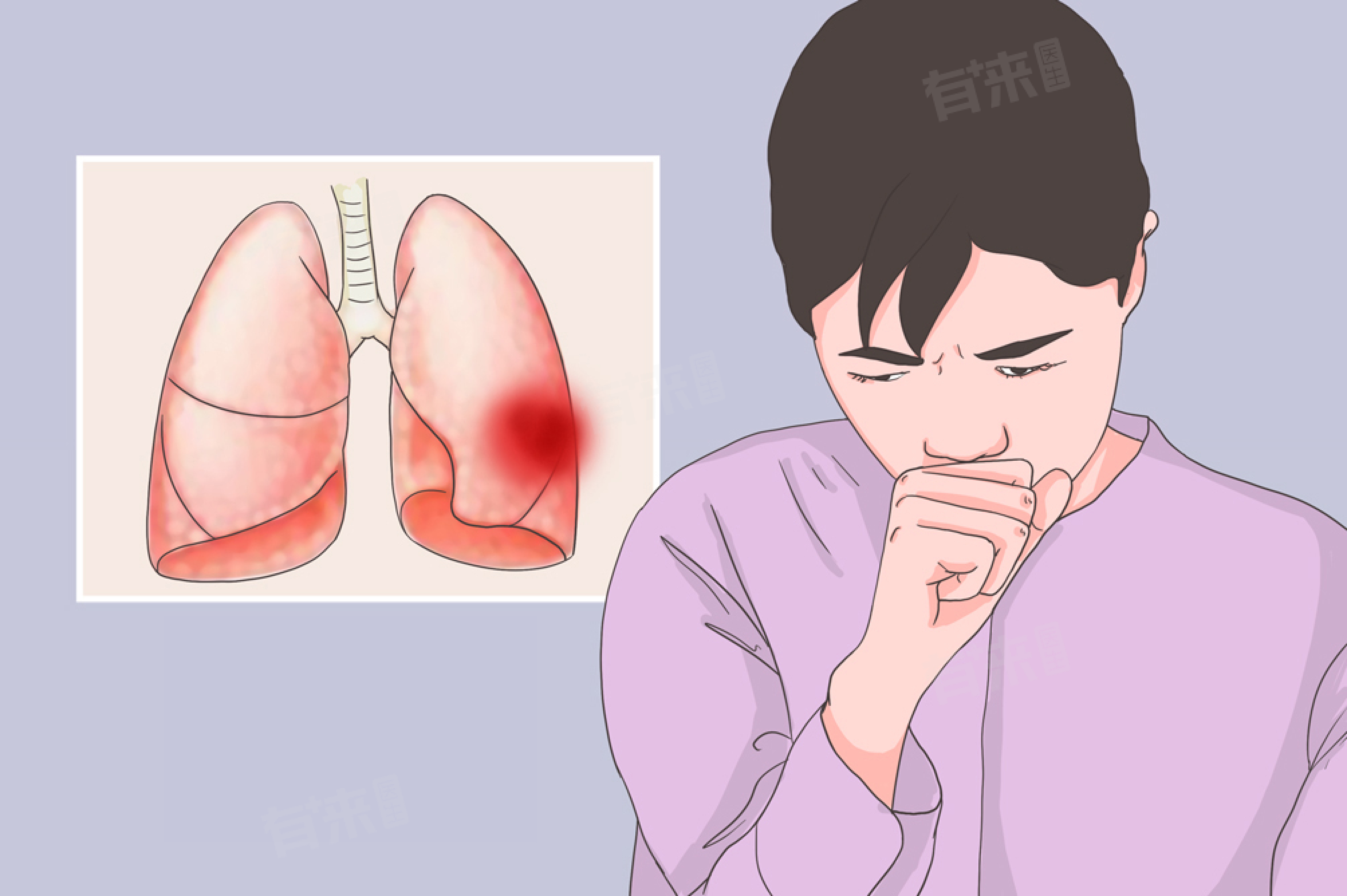 肺热有哪些症状表现又如何根治