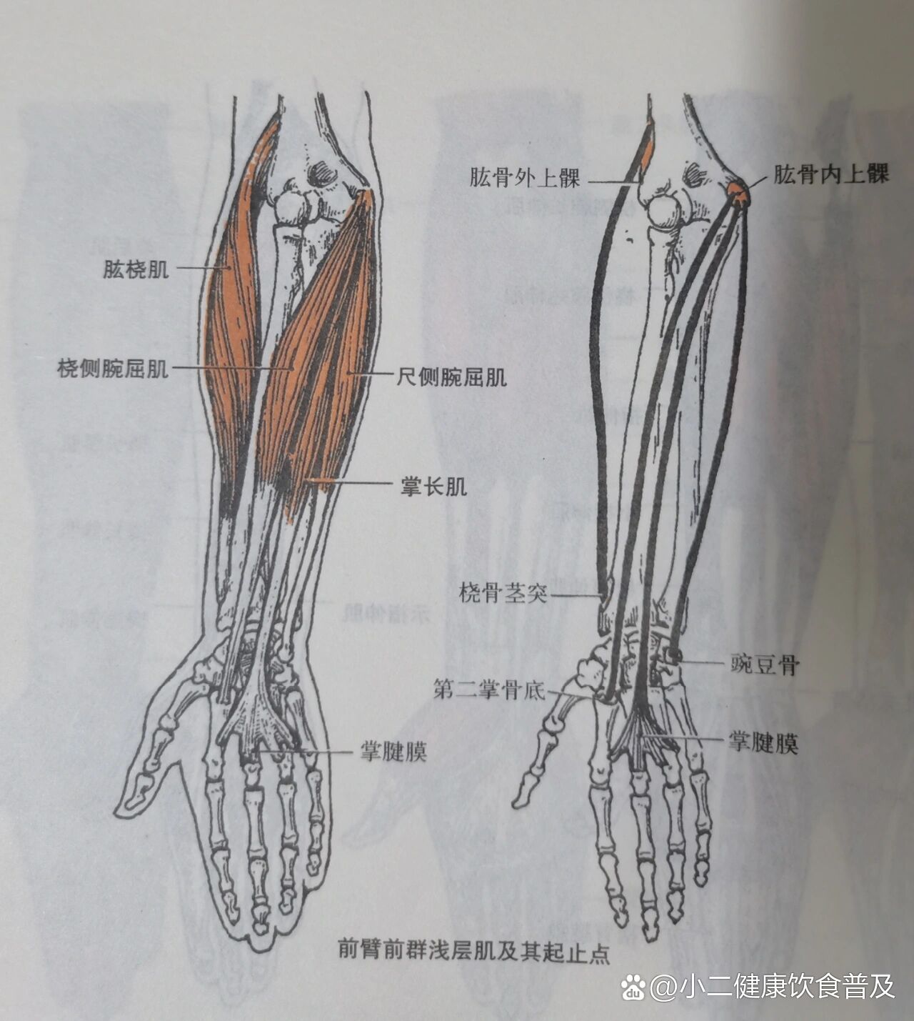 桡侧腕屈肌起止点图片