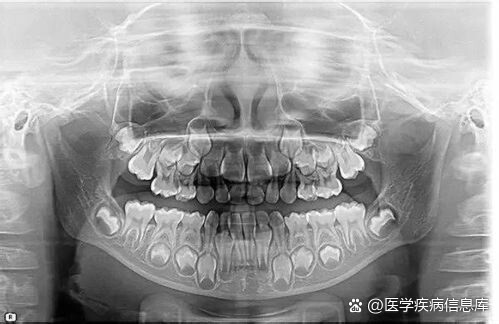 今天牙牙就给讲讲怎么看口腔全景片!93 br>96首先